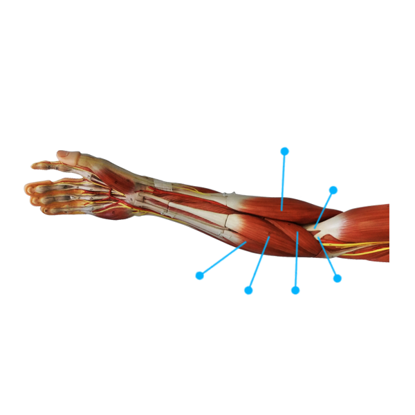 Forearm-View2