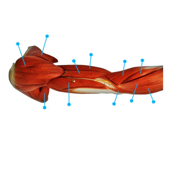 Arm-View1